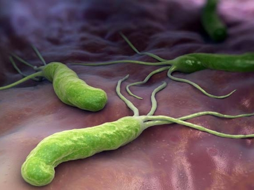 Câncer de estômago: tratar bactéria H. pylori reduz risco de complicações