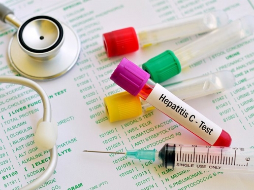 Hepatite: o número de infecções não para de crescer