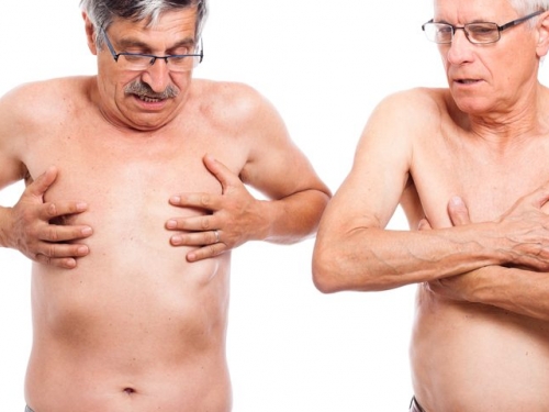 Preconceito dificulta diagnóstico de câncer de mama em homens, afirmam especialistas