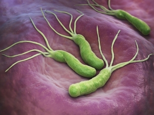 H. Pylori positivo é sinal de câncer?