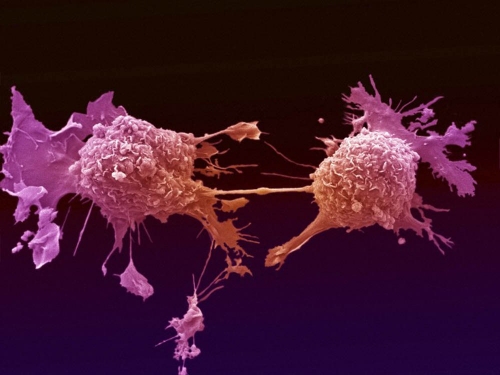 Mutações do câncer vivem em células saudáveis