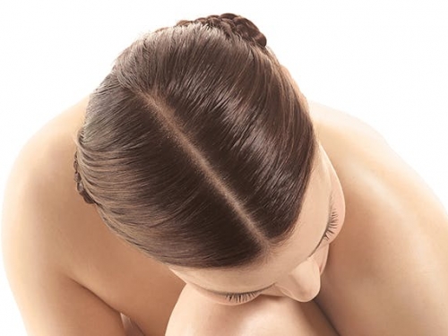 Radiação solar no couro cabeludo pode causar câncer ou perda de cabelo