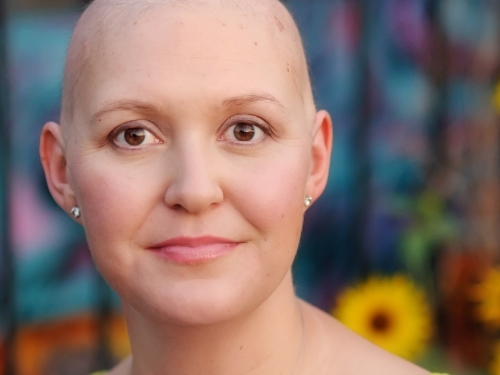 Especialistas desvendam 10 mitos sobre o câncer