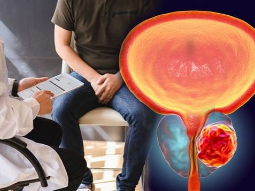 Tratamentos de câncer de próstata são menos invasivos e mais eficazes