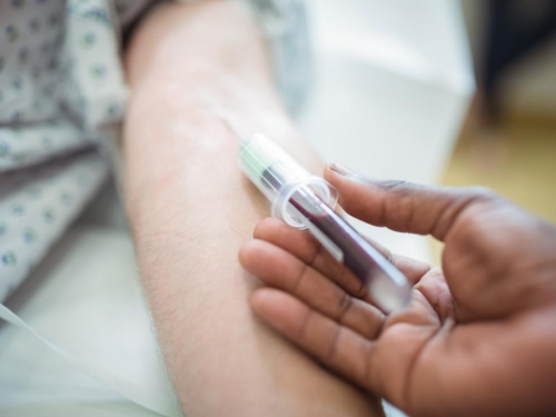Novo exame de sangue pode detectar até 50 tipos de câncer