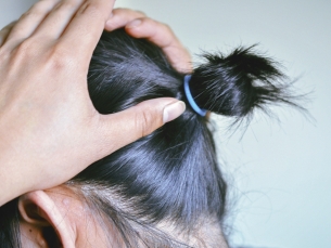 Terapia com led acelera recuperação do cabelo após quimioterapia