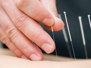 Os benefícios da acupuntura no paciente com câncer